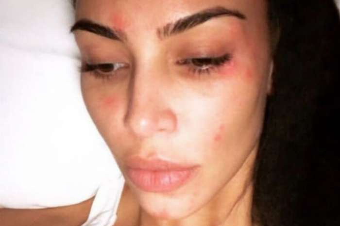 Kim Kardashian Shares New Pic Of Psoriasis As She Continues To Battle With The Skin Condition
