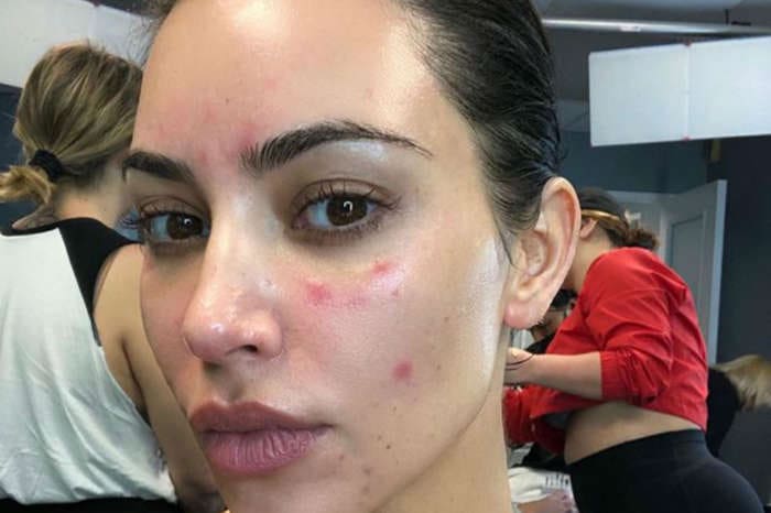 Kim Kardashian Opens Up About Her Struggle With Psoriasis - 'The Pain Was So Unbearable'