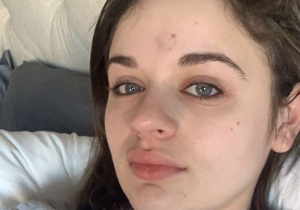 Patricia Arquette Accidentally Injures Her The Act Co-Star Joey King With Golden Globe Trophy
