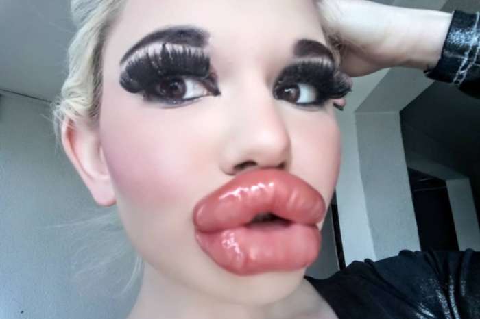 Andrea Ivanova Goes Viral After Getting 20 Lip Injections — Real Life Barbie Wants The Biggest Lips In The World