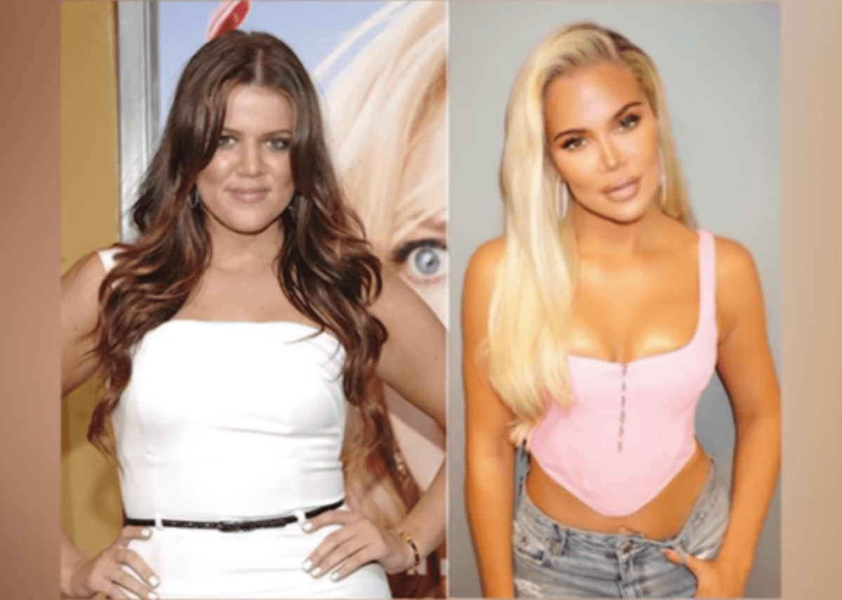 Khloe-Kardashian-Before-and-After.png