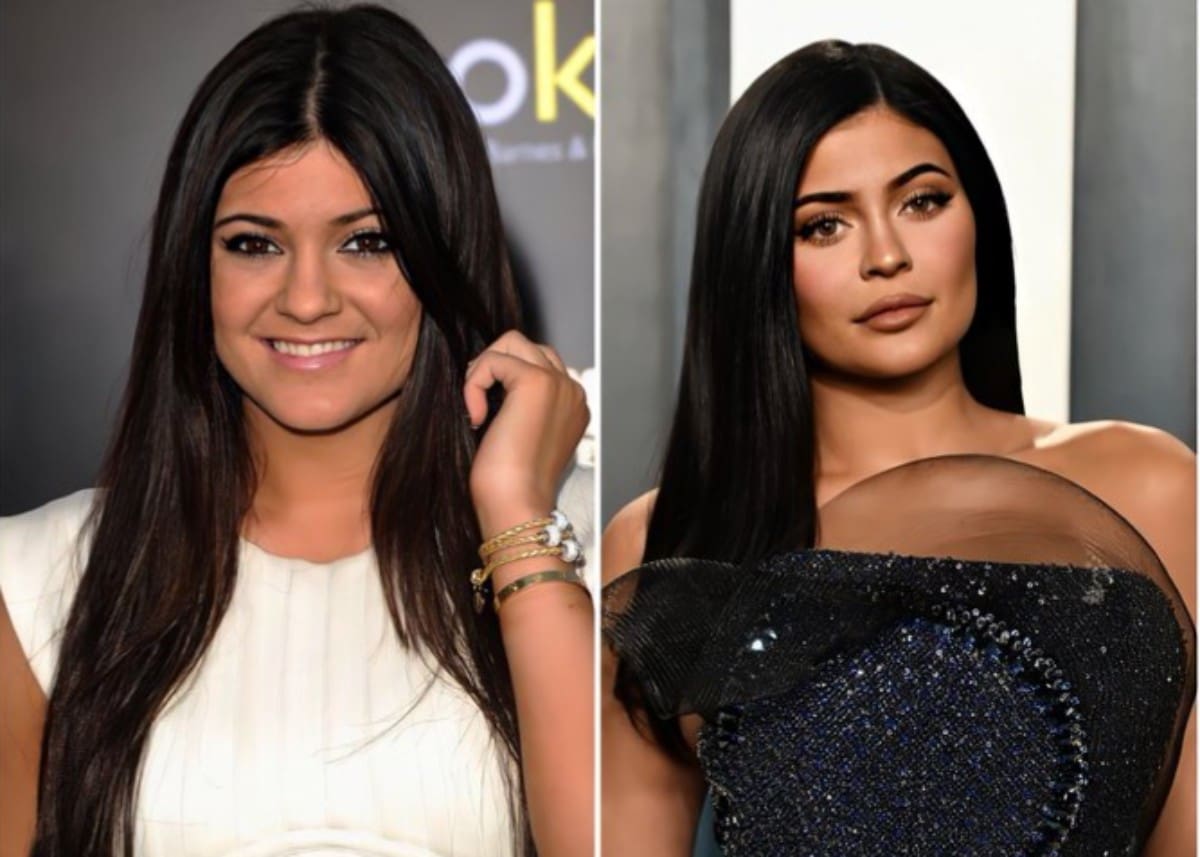 These Before And After Photos Of Kylie Jenner Will Have ...