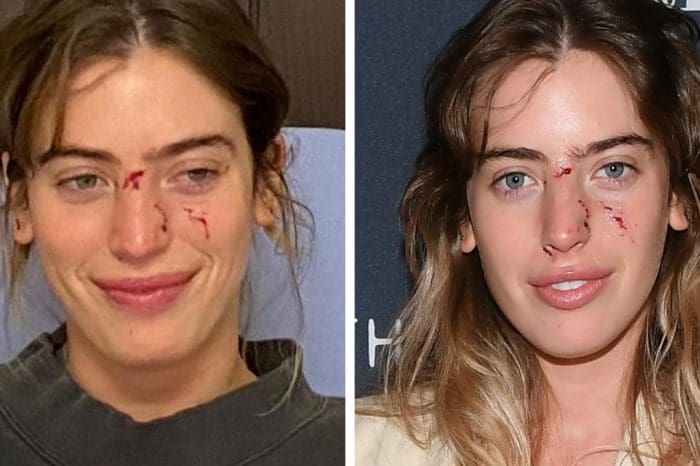 Ewan McGregor's Daughter Attends His Movie Premiere Right After Dog Bites Her In The Face!