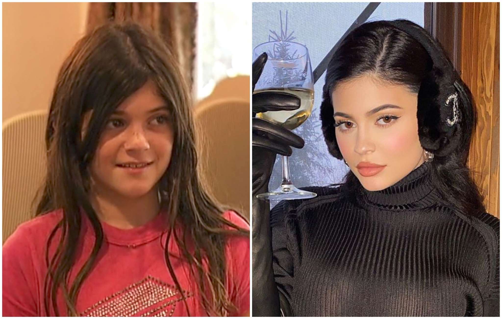 kuwtk-kylie-jenner-says-that-lip-fillers-helped-with-her-insecurities