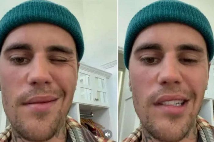 Can't smile and blink with one eye 28-year-old Justin Bieber paralyzed half of his face