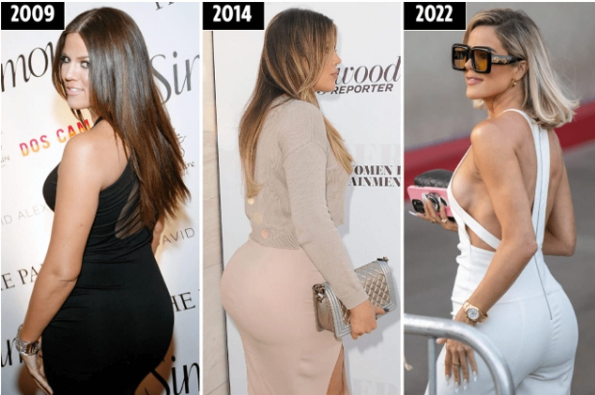 Fans of Khloe Kardashian suspect that she got rid of implants in the buttocks