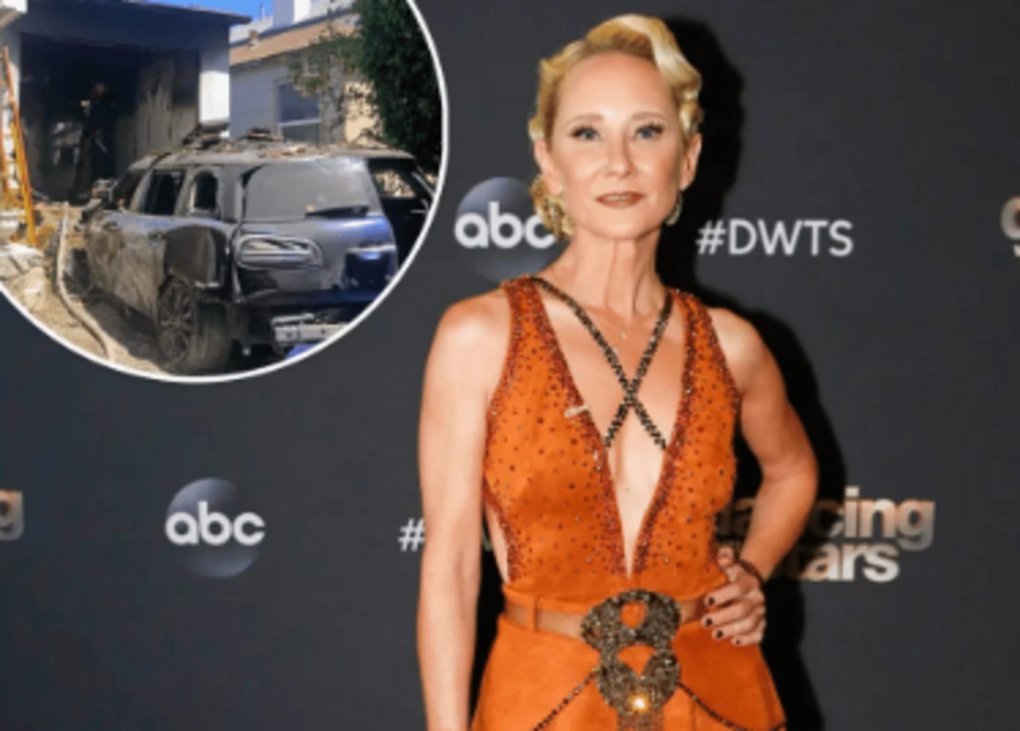 Due To Thermal Wounds And Smoke Inhalation, Anne Heche Passed Away